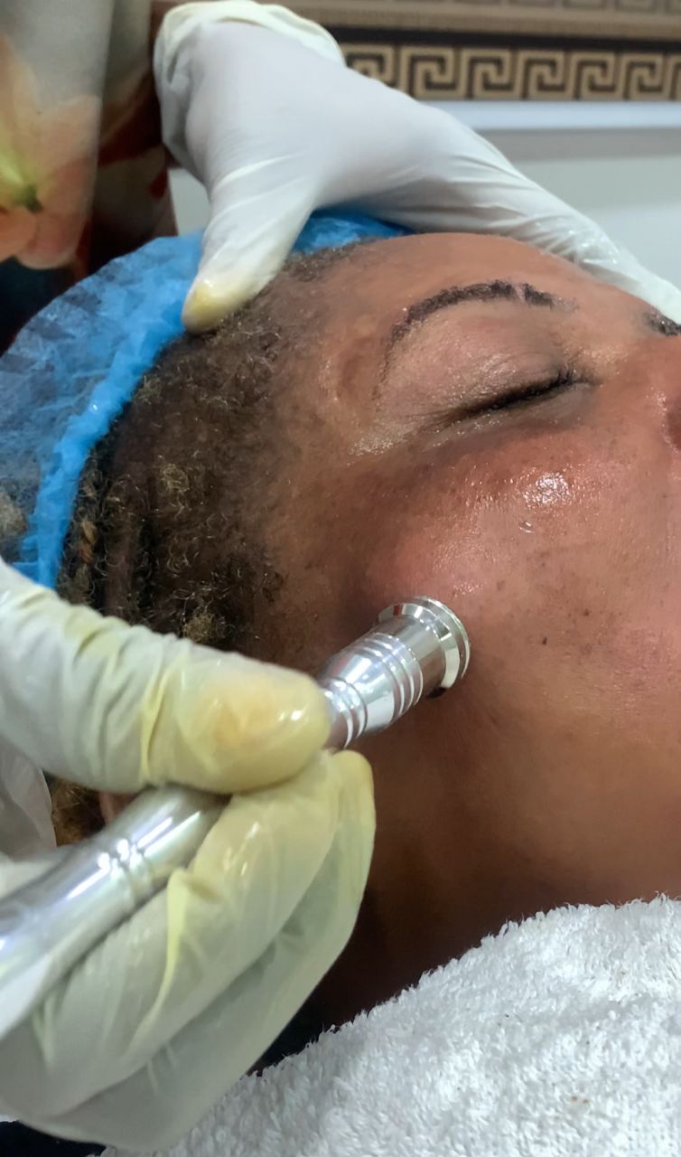 Hydrafacial Treatments